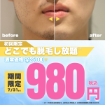 ロゴ：＼【夏本番】肌見せの季節、ムダ毛ケアはお済みですか？／メンズ脱毛サロン「メンズクリア」初回体験980円！